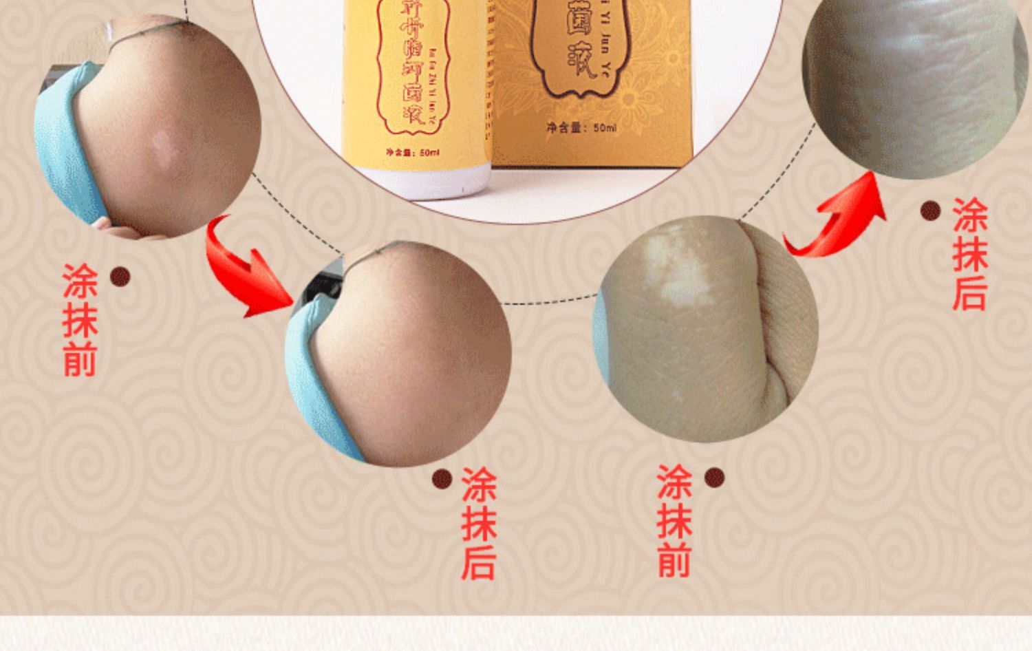 Sửa chữa hoa mẫu đơn trắng melanin mảng bám tăng trưởng chất lỏng trắng đờm lưới che khuyết điểm psoralen không che phủ chất lỏng kem che khuyết điểm mac