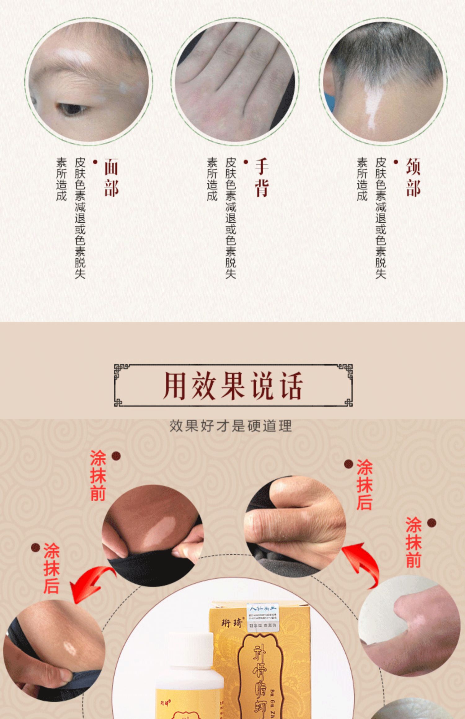 Sửa chữa hoa mẫu đơn trắng melanin mảng bám tăng trưởng chất lỏng trắng đờm lưới che khuyết điểm psoralen không che phủ chất lỏng kem che khuyết điểm mac