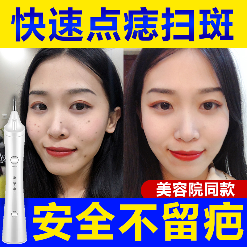 Golden Rice Dot Mole pens beauty salon special to mole mole spot Mole Spots for Domestic