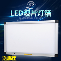 Jixin X-Ray viewing Lamp ct lamp dental led viewing lamp box reading lamp triple viewing device double Orthopedics