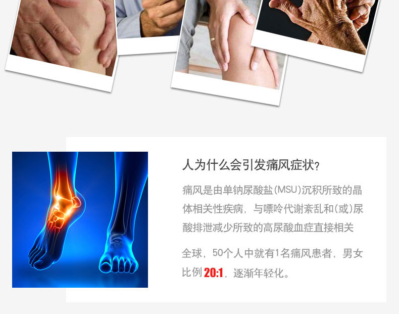 Mỹ Đen Cherry Viên nang cô đặc Gouty Ling Viên nang Axit uric thấp khớp Nhập khẩu Axit Gout chính hãng Sản phẩm sức khỏe - Thức ăn bổ sung dinh dưỡng thuốc thực phẩm chức năng