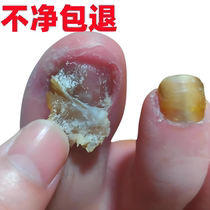 (Watsons best seller) Remove 99% of gray potassium fungus with just one drop no guarantee or repair no guarantee of return if invalid