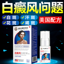 Vitiligo external use of melanin growth sweat spots on hands body psoralen tincture whitening artifact