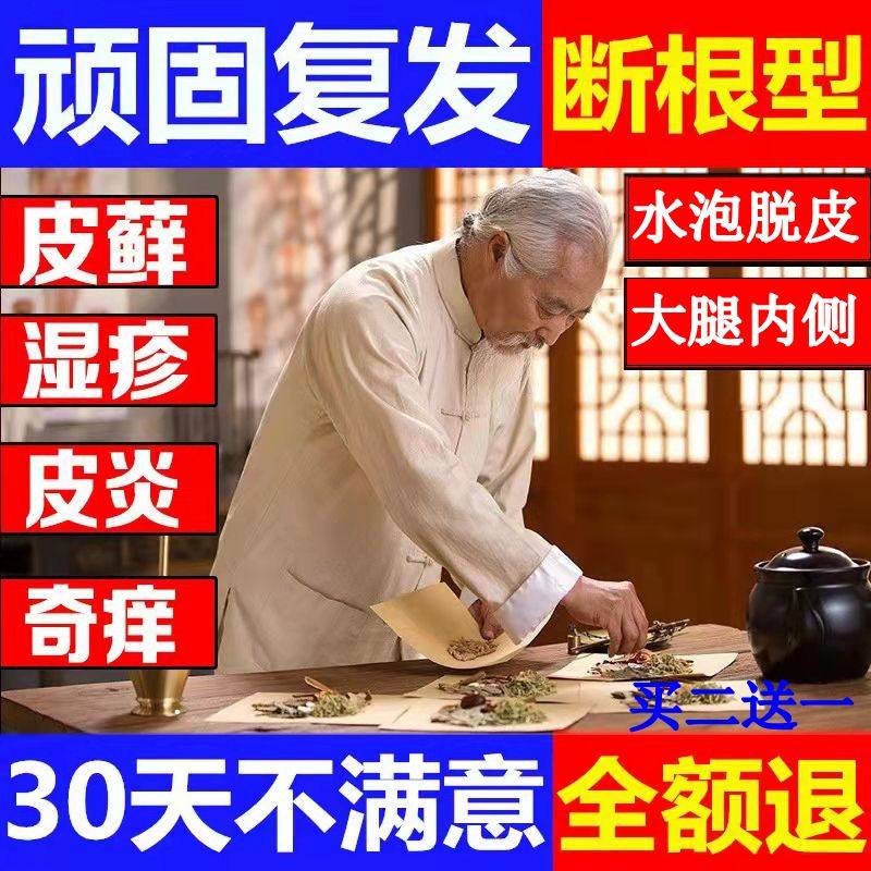 Sanzhen Qing Zijiao ringworm tincture topical psoriasis ointment hand and foot peeling blisters skin itching antibacterial ointment