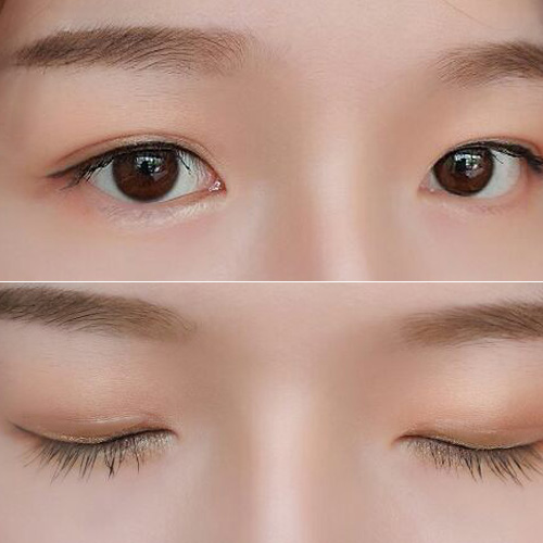 Xi Ling Light Color Dot double eye leather patch invisible nature not easy to reflect net red fairy post Olive Shaped Flesh color No marks