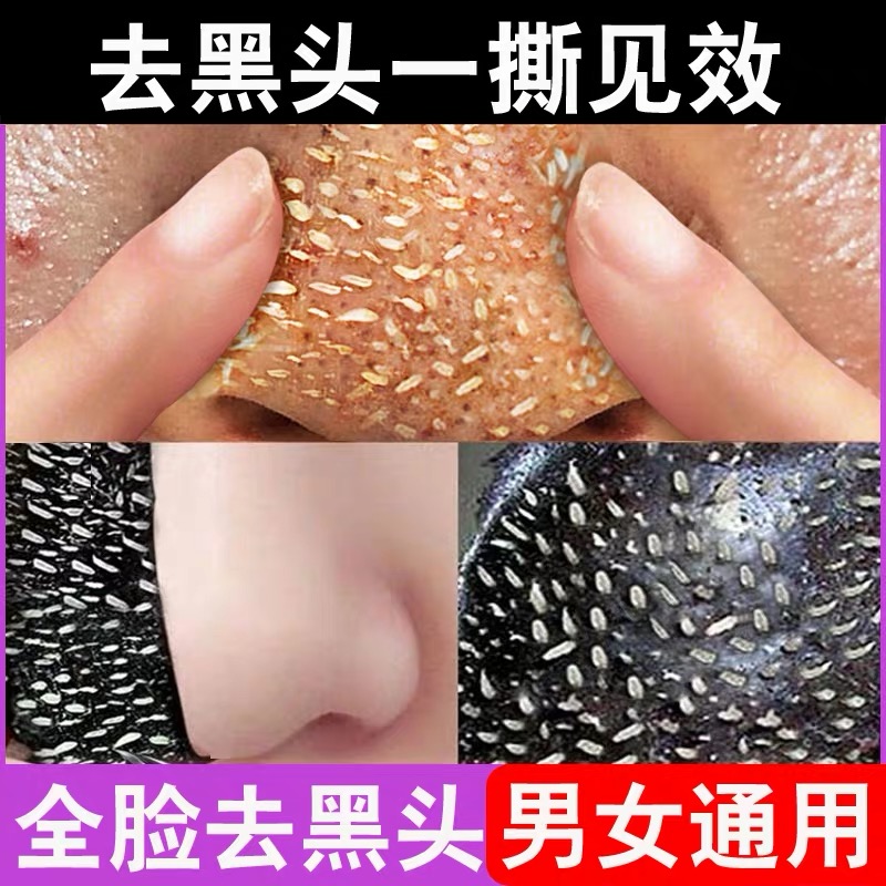 Nine-leaf grass Qingyan bamboo charcoal blackhead mask tear-off nose sticker to shrink pores set to remove blackheads and acne