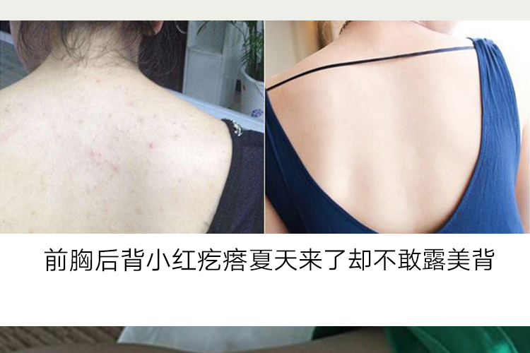 bình xịt côn trùng thái lan Man Ting Green Pepper Loại bỏ Aphid Spray Chất lỏng không diệt khuẩn Bộ đồ giường gia đình Giặt vật nuôi chống bụi - Thuốc diệt côn trùng bình xịt muỗi hiệu quả