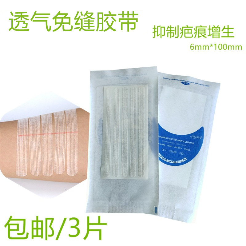 3 sheet self-adhesive breathable slit-free adhesive tape skin wound stitching lazyback slimpers Caesarean section Cesarean Inhibition of Scar Hyperplasia