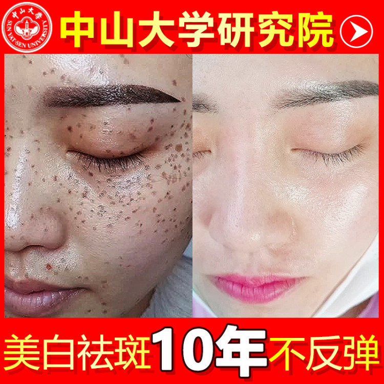 Sleep Disclosure Mask Free Moisturizing and Making Whitening to Yellow Lighting Color Painting Color for Students