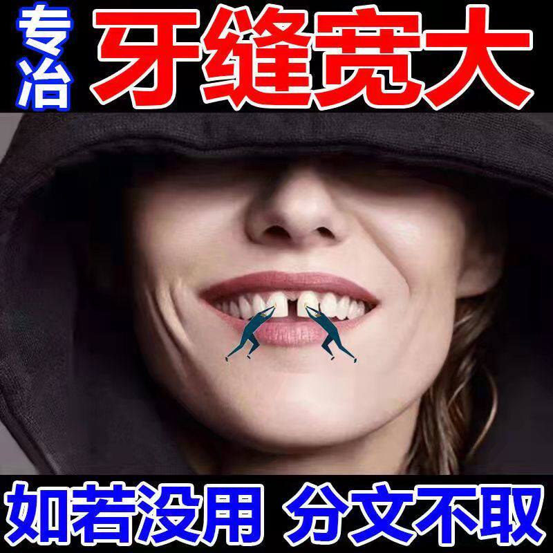 Door teeth Tooth Deficiency Temporary Braces for eating anti-sedenture Tooth Slit Leniency Restoration God Tooth Cover False Tooth Temporary single