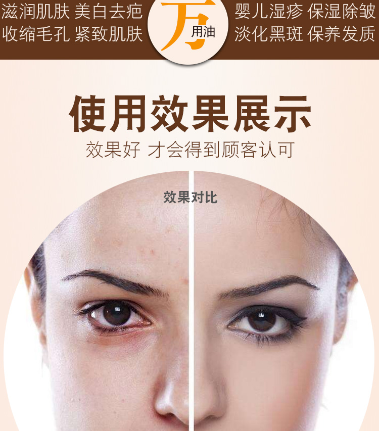 Nhật Bản chính gốc Hokkaido gấu trang trại tinh dầu ngựa nguyên chất Q10 Showa Johor Bahru kem dưỡng ẩm mờ - Kem dưỡng da dưỡng ẩm da