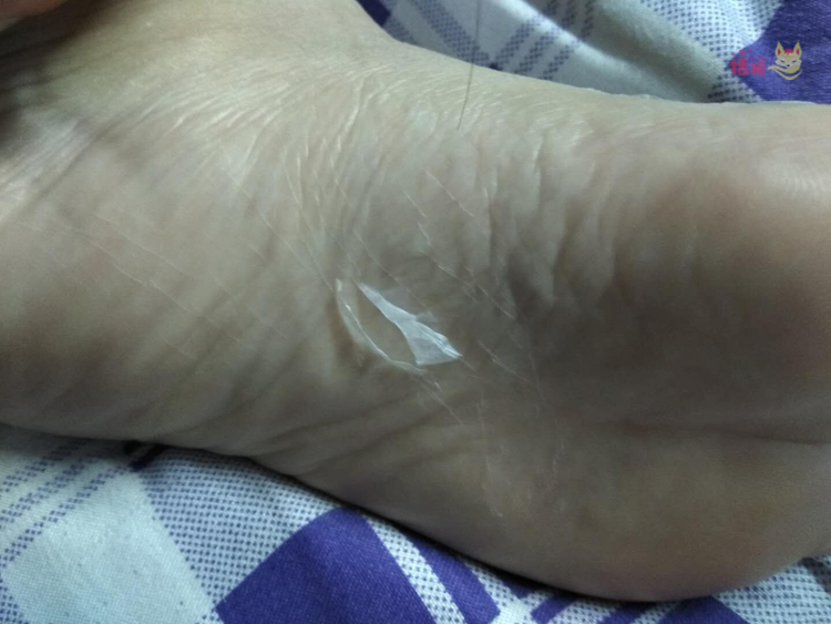Lột mặt nạ chân đặt cho da chết cũ dịu dàng dịu dàng gót chân khô nứt chân phim dịu dàng chân tẩy tế bào chết bộ chăm sóc bàn chân kem dưỡng ẩm tay chân