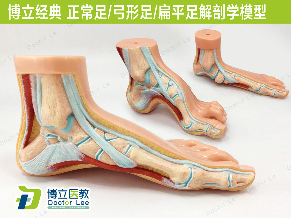 高端3款1:1足病理对比扁平足 弓形足 健康足模型走路姿势矫正模型