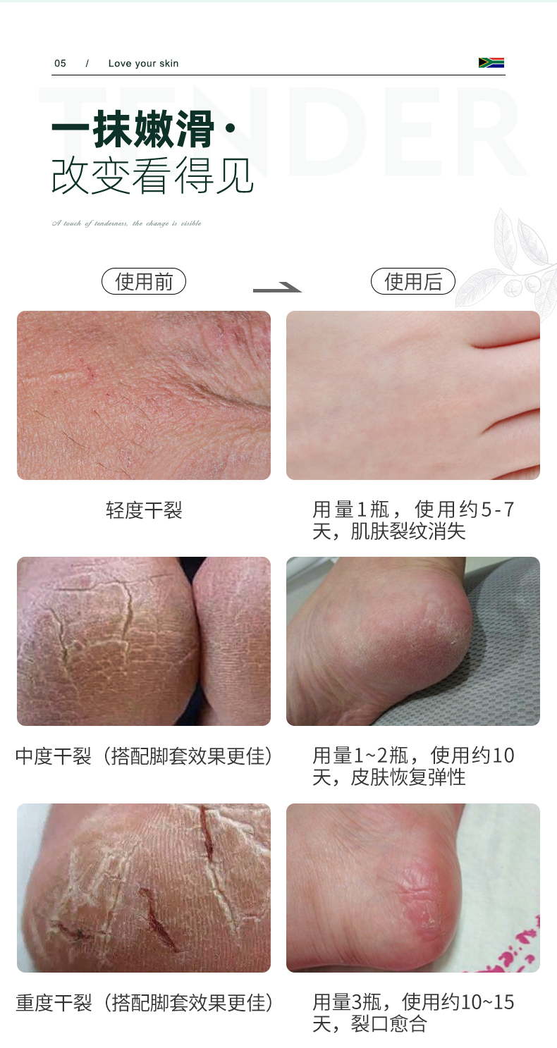 南非四大宝之一 ingrams 草本樟脑护手霜 150ml 手脚防干裂7天见效 图7