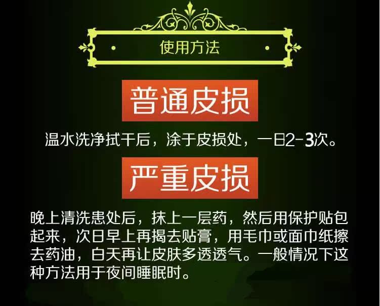 黑豆馏油外用药膏特效无激素面部脂溢性皮炎头