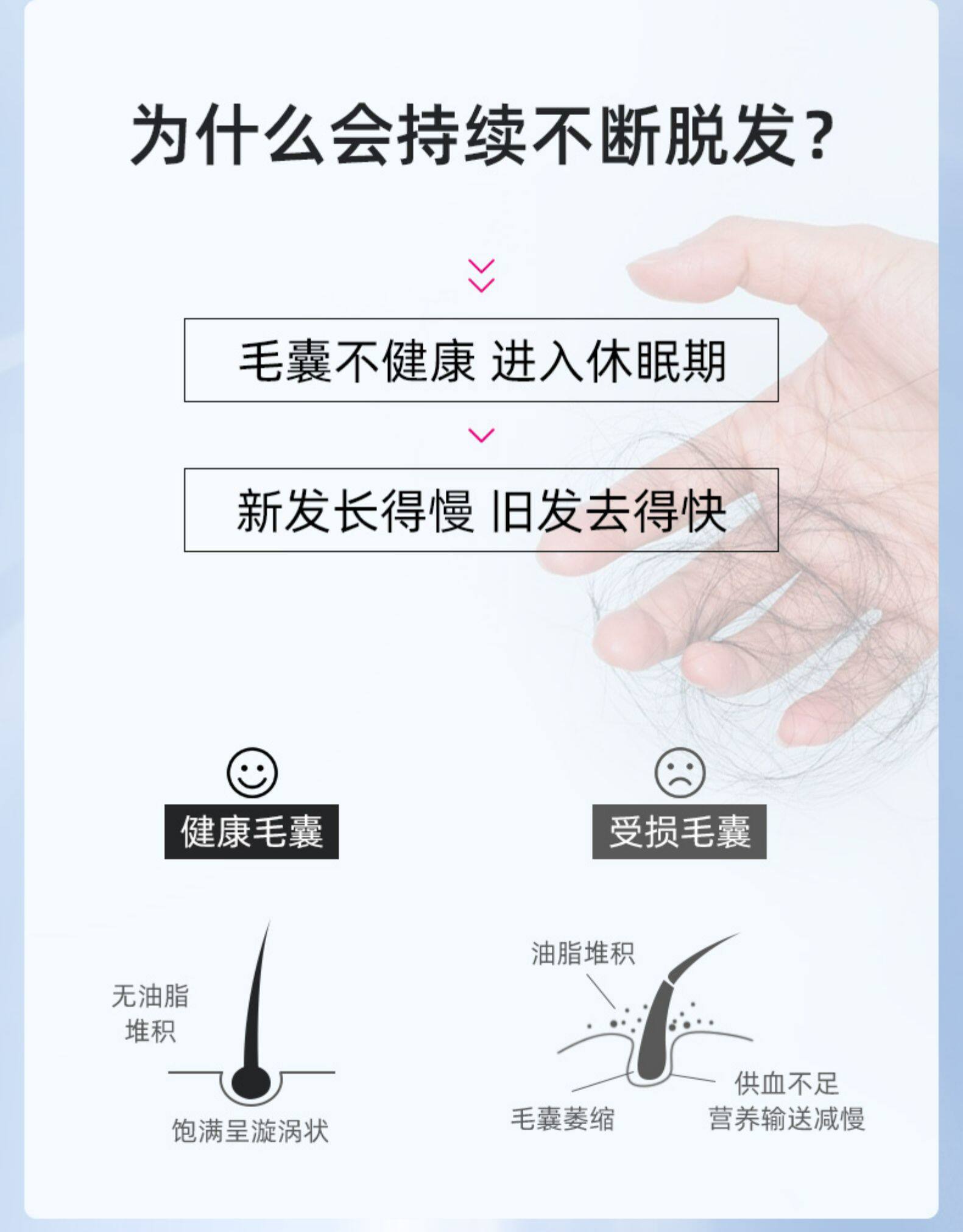 达霏欣 5%米诺地尔酊搽剂 防脱发生发增发液 30ml 图10