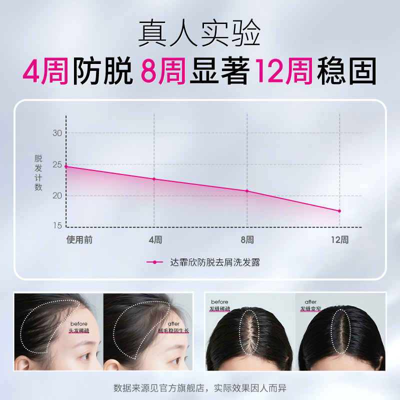 达霏欣防脱洗发水到底有没有用?脱发党亲测分享!_头发护理_淘宝美妆网