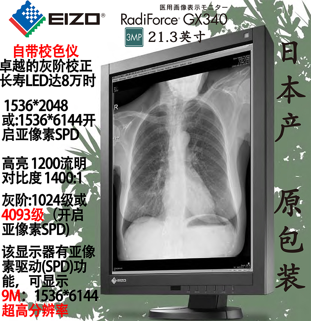 CR CT medical display medical EIZO art zhuo gray scale black and white GX240 GX340 GS220 320 520