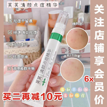 Large package 20g fve clear face with acne Acne Gel Downpall Pimple Acne closed mouth