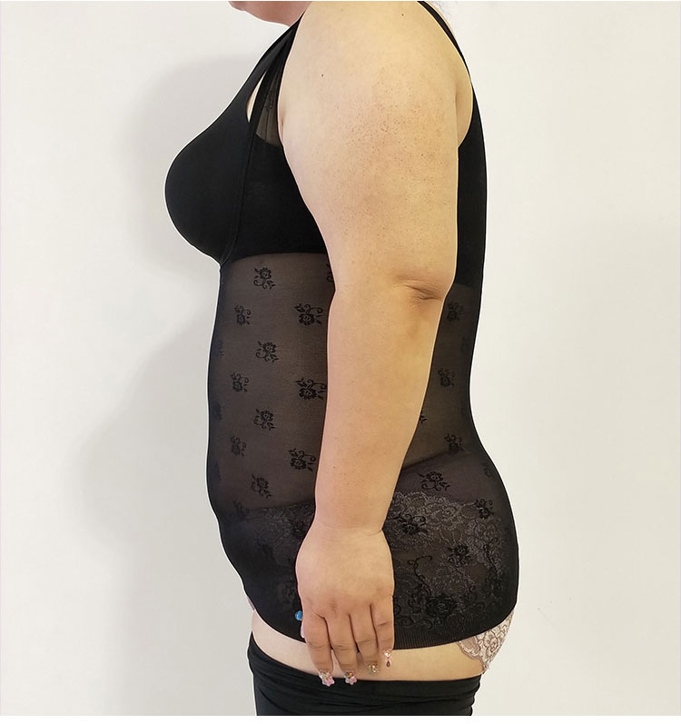 Người hâm mộ Peel 4894/4836 2018 hè mới cỡ lớn chất béo MM200 pounds giảm béo corset hàng đầu do lot