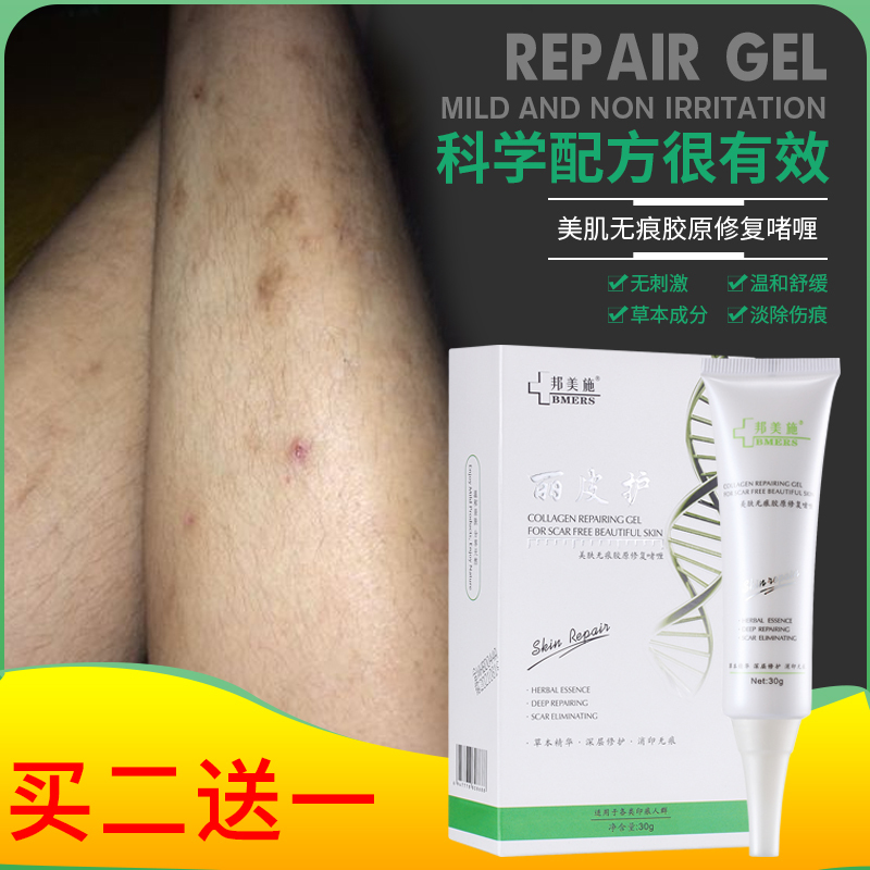 Scar Removal Cream to Fade Scars, Reduce Melanin Deposits, Remove Black Marks on Legs, Repair Skin from Scratches, and Remove Mosquito Bites Scar Removal Cream to Fade Scars, Reduce Melanin Deposits, Remove Black Marks on Legs, Repair Skin from Scratches, and Remove Mosquito Bites