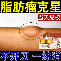 The lipomas special effect anointed multiple fatty tumor anoma removed the artist castor fatty tumor