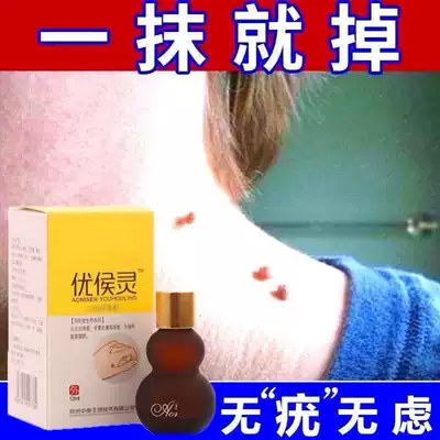 Long small meat on the neck, filamentous monkeys, no scars, neck removal, long hard bumps on the feet, hands and feet