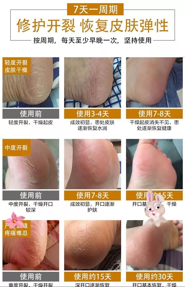 Nhật Bản dầu ngựa rõ ràng kem chân [2 tặng 1] kem chống ngứa kem chăm sóc bàn chân 妍 瑟 清 足 膏 正品 kem trị nứt gót