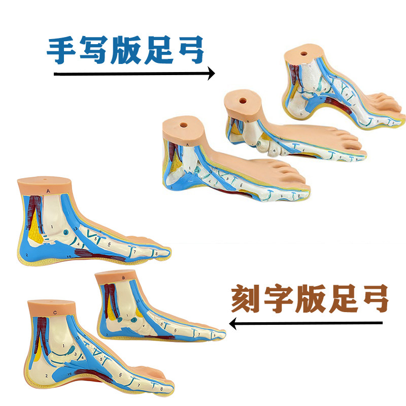 手写版刻字版正品医学正常足扁平足弓形足高弓足模型 运动系统