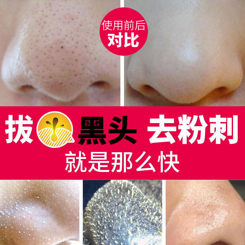 Head export liquid and shrink pores Go to black fine Chinese liquid suit Clean powder Spurs dissolution liquid male female students special