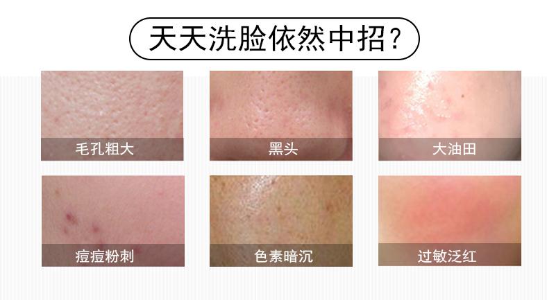 礽 kem làm sạch hạt óc chó, tổng giám đốc đầu tiên của Vân Nam Baiyao, Zhou Jiaxuan, nghiên cứu và phát triển sữa rửa mặt nhau thai cừu