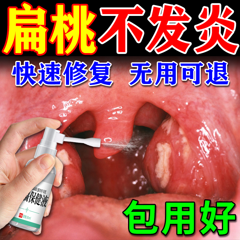 Tonsillitis Medicine for Sore Throat and Swelling, Effective Medicine for Children with Sore Throat, Enlarged Tonsils, and Foreign Body Sensation Spray