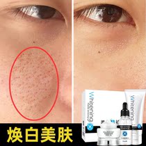 Whitening facial cleanser freckle black cream set to skin skin products to dull and remove yellow