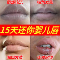 Mouth corner melanin removes lips to dark pigmented mouth dark surrounding dark and tender red vegetarian