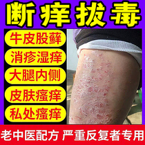 Platinum Can Fen Cream Female Trimellow Grass Benthum Bentang Bacteriostatic Cream Like snake oil paste Bacteriostatic Anti-Itch Cream