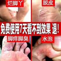 Beauty Floating Skin Special Skin Antibacterial Liquid Gel Official Flagship Store Painted Clear Suit Foot Itching Beauty Float official web