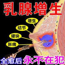 Buy 2 sent for 1 Wan Ku Congtong mammary glands with Wu Chuanguan official Internet Miracle Milk Tranquility and Dredging Knot and Knot Knot Hard Lump