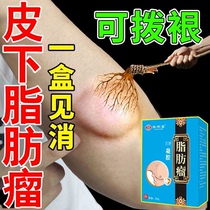 Fat Retention of the Cream Removal of the Divine Eliminated Epidermis of the Pink Retention of Subcutaneous Multiple Fat Packs of Stars in Hard Block Sacks