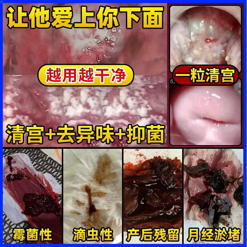 Gynecological Pull Line Qinggong Pills Vaginal Detoxification Uterine Ovary Maintenance Private Parts Care Deodorization Itching Cleaning