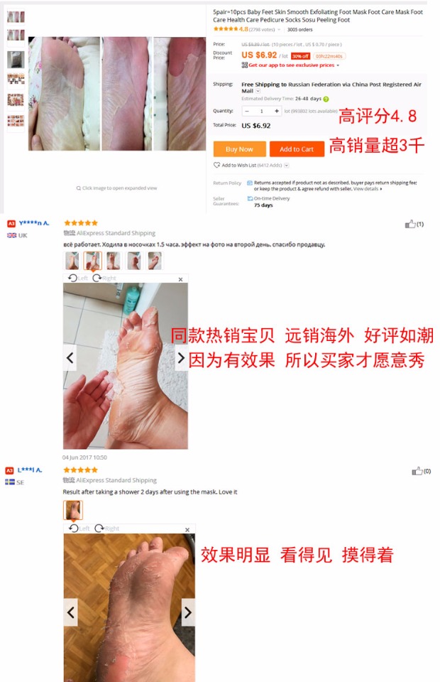 Bàn chân tẩy da chết tẩy tế bào chết để loại bỏ da chết kem trị nứt gót chân