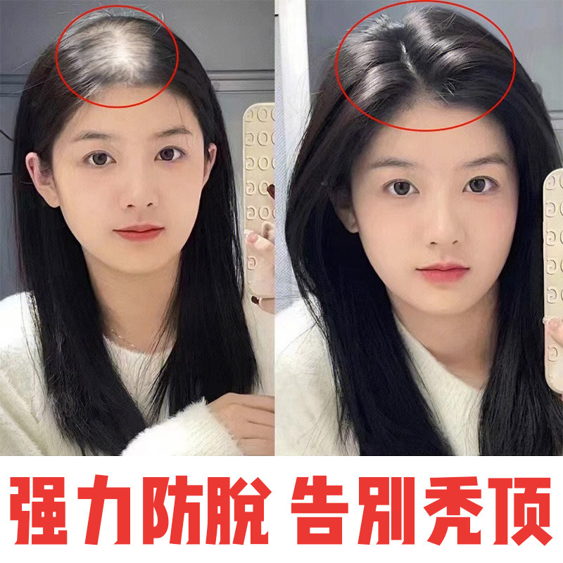 拯救脱发危机：头发稀疏的秘密武器，建议收藏！