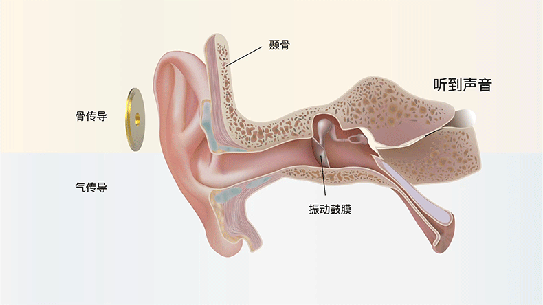 Проводные HiFi наушники uniquemelody/um mest mkii 2代骨传导静电混合耳机 入耳式耳塞