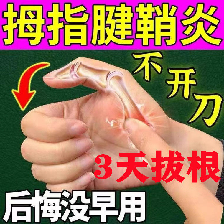 (10,000 people have been treated) tendon sheath paste wrist thumb paste special for finger joint pain relax tendon sheath ointment
