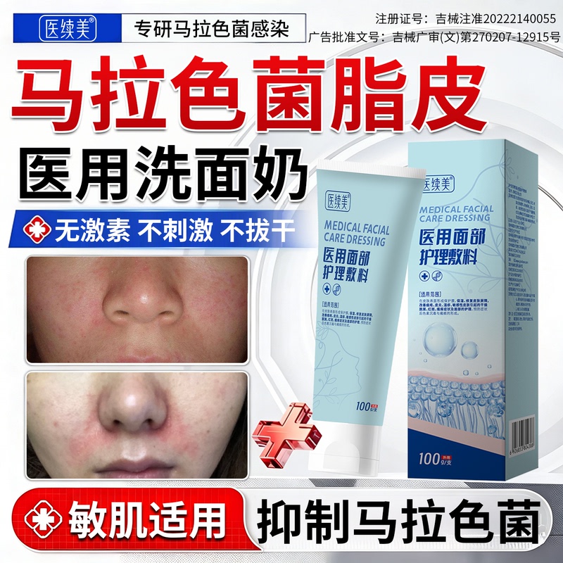 Malassezia Seborrheic Dermatitis Facial Cleanser, Facial Repair Skin Care Products, Medical Cleansing, Antibacterial, Oil Control, Acne Removal Rw Malassezia Seborrheic Dermatitis Facial Cleanser, Facial Repair Skin Care Products, Medical Cleansing, Antibacterial, Oil Control, Acne Removal Rw
