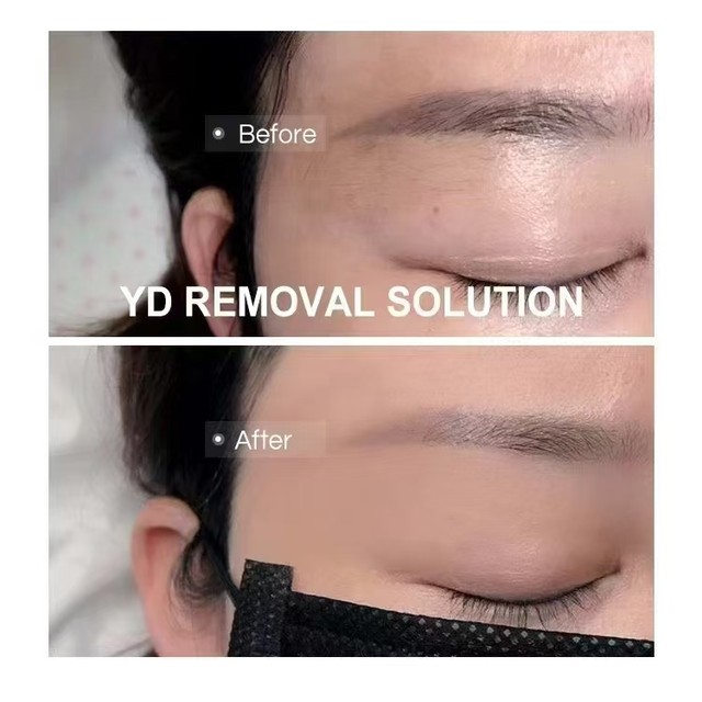 Yd Tattoo Fade Agent Restoration Liquid Eyebrow, Eye, and Lip Correction Liquid Red Eyebrow Deep Eyebrow Line Lightening Auxiliary Agent Nai Xiuni