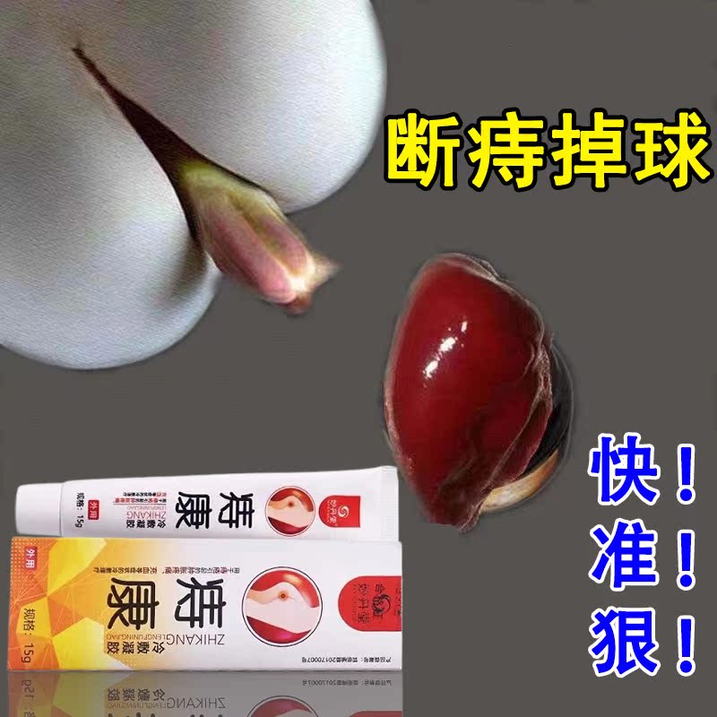 Hemorrhoid ointment special effect meat elimination ball broken hemorrhoid ointment internal hemorrhoid external hemorrhoid prolapse