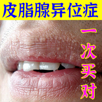 (not to be allergic to good use) Sebaceous glands Abnormal Taste Lips Proliferation Mouth Corner of Lip Skin Sebaceous Glands Heterosis