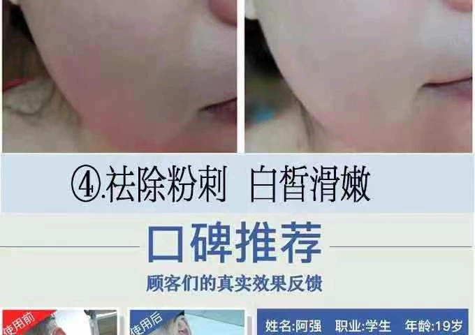 Làm xanh da thủy tinh trẻ hóa da làm sạch sâu lỗ chân lông Kem massage mặt làm sạch da mặt - Kem massage mặt kem massage mặt spa