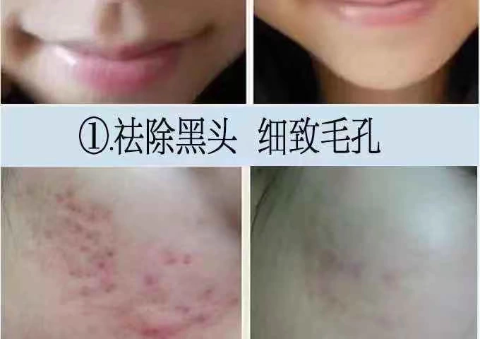 Làm xanh da thủy tinh trẻ hóa da làm sạch sâu lỗ chân lông Kem massage mặt làm sạch da mặt - Kem massage mặt kem massage mặt spa