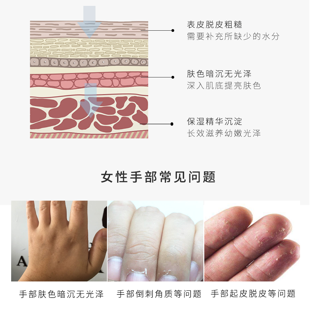 Tẩy tế bào chết sừng cũ làm trắng giữ ẩm chống khô sửa chữa bản chất chăm sóc tay bảo trì sốt mặt nạ tay kem lột da tay chân